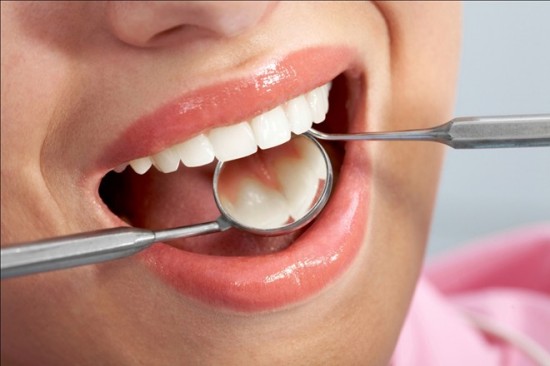 Hiểu rõ thêm về phương pháp tẩy trám răng